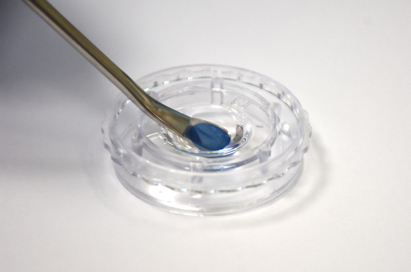 מבט מקרוב על הקרנית המודפסת של Precise Bio. הושתלה במטופלת במרכז הרפואי רמב"ם